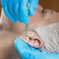 Auriculoterapia